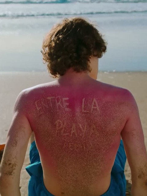 Homem queimado de sol de costas